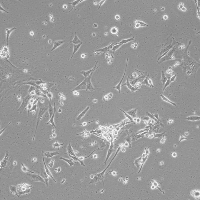 C-33 A Cells人子宮頸癌復(fù)蘇細胞系(有STR鑒定圖譜),C-33 A Cells