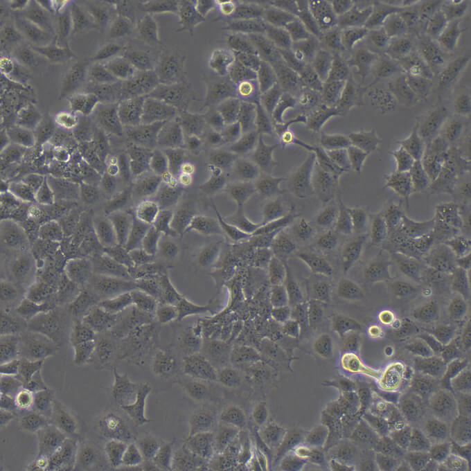 Calu-3 Cells人肺腺癌復(fù)蘇細(xì)胞系<胸水>(有STR鑒定圖譜),Calu-3 Cells