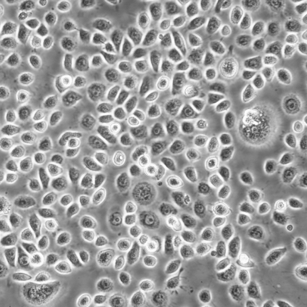 Hela Cells人宮頸癌復(fù)蘇細(xì)胞系(有STR鑒定圖譜),Hela Cells