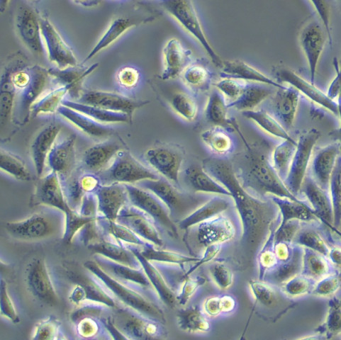 Hep G2 Cells人肝癌復(fù)蘇細(xì)胞系(有STR鑒定圖譜),Hep G2 Cells