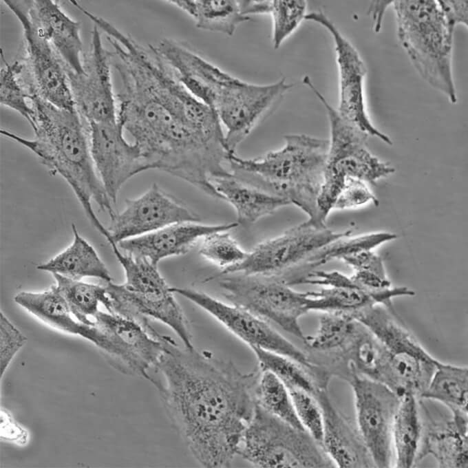 HFL1 Cells人胚肺成纖維復(fù)蘇細(xì)胞系(有STR鑒定圖譜),HFL1 Cells