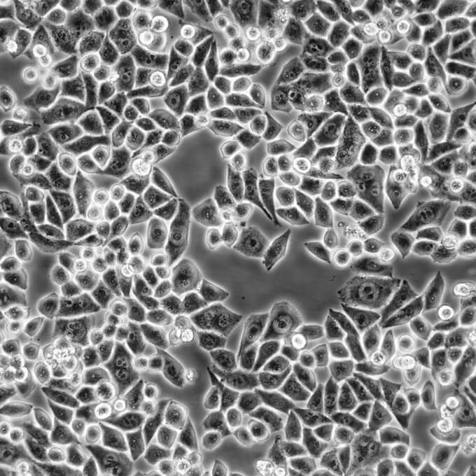 NCI-H292 Cells人肺癌復(fù)蘇細(xì)胞系<淋巴結(jié)轉(zhuǎn)移>(有STR鑒定圖譜),NCI-H292 Cells