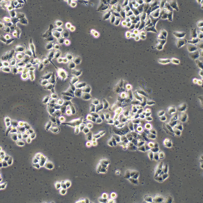 SCaBER Cells人膀胱鱗癌復(fù)蘇細胞系(有STR鑒定圖譜),SCaBER Cells