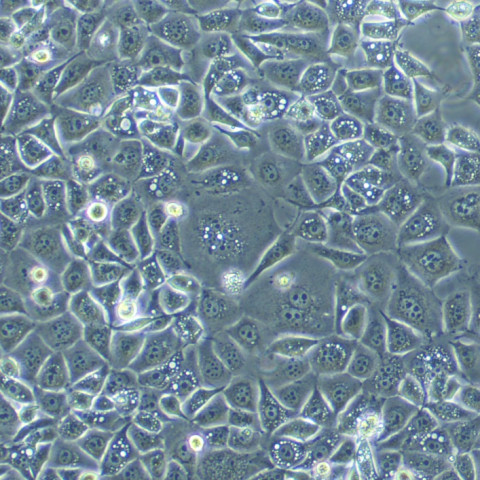 SK-Hep-1 Cells人肝竇內(nèi)皮復(fù)蘇細(xì)胞系(有STR鑒定圖譜),SK-Hep-1 Cells