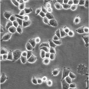 786-O Cells人腎透明細胞腺癌復蘇細胞系(有STR鑒定圖譜),786-O Cells