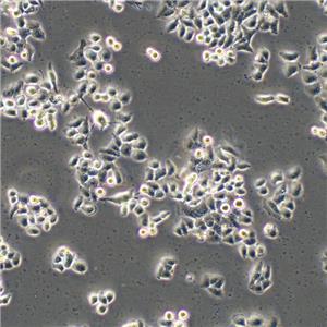 22RV1 Cells人前列腺癌复苏细胞系(有STR鉴定图谱)