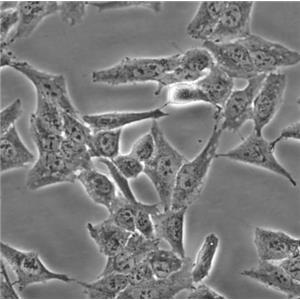 A-431 Cells人表皮癌復(fù)蘇細(xì)胞系(有STR鑒定圖譜),A-431 Cells