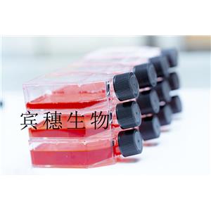 AAV-293 Cells人胚腎復(fù)蘇細(xì)胞系(有STR鑒定圖譜),AAV-293 Cells