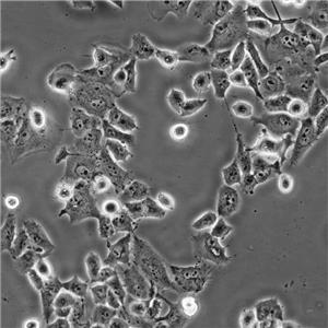 BT-549 Cells人乳腺管癌復(fù)蘇細胞系(有STR鑒定圖譜)