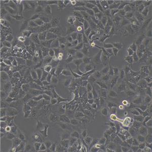 Calu-3 Cells人肺腺癌復蘇細胞系<胸水>(有STR鑒定圖譜)