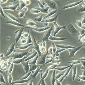 HEC-1-A Cells人子宮內(nèi)膜腺癌復(fù)蘇細胞系(有STR鑒定圖譜)