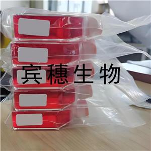 J82 Cells人膀胱移行癌復蘇細胞系(有STR鑒定圖譜),J82 Cells