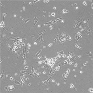 HEC-1-B Cells人子宫内膜腺癌复苏细胞系(有STR鉴定图谱)