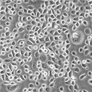 Hela Cells人宮頸癌復蘇細胞系(有STR鑒定圖譜)