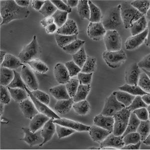 Hep 3B2.1-7 Cells人肝癌复苏细胞系(有STR鉴定图谱)