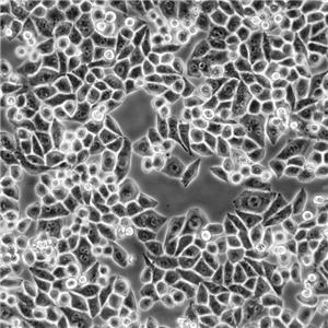 NCI-H292 Cells人肺癌復蘇細胞系<淋巴結轉移>(有STR鑒定圖譜)