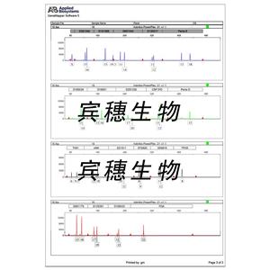 Detroit 562 Cells人咽頭癌胸水轉(zhuǎn)移復(fù)蘇細(xì)胞系(有STR鑒定圖譜),Detroit 562 Cells