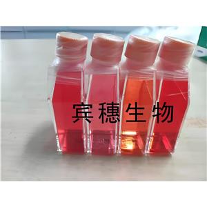 SW 780[SW-780, SW780] Cells人膀胱移行癌復(fù)蘇細(xì)胞系(有STR鑒定圖譜),SW 780[SW-780, SW780] Cells