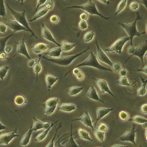 NCI-H2170 Cells人肺鱗癌復(fù)蘇細胞系(有STR鑒定圖譜),NCI-H2170 Cells