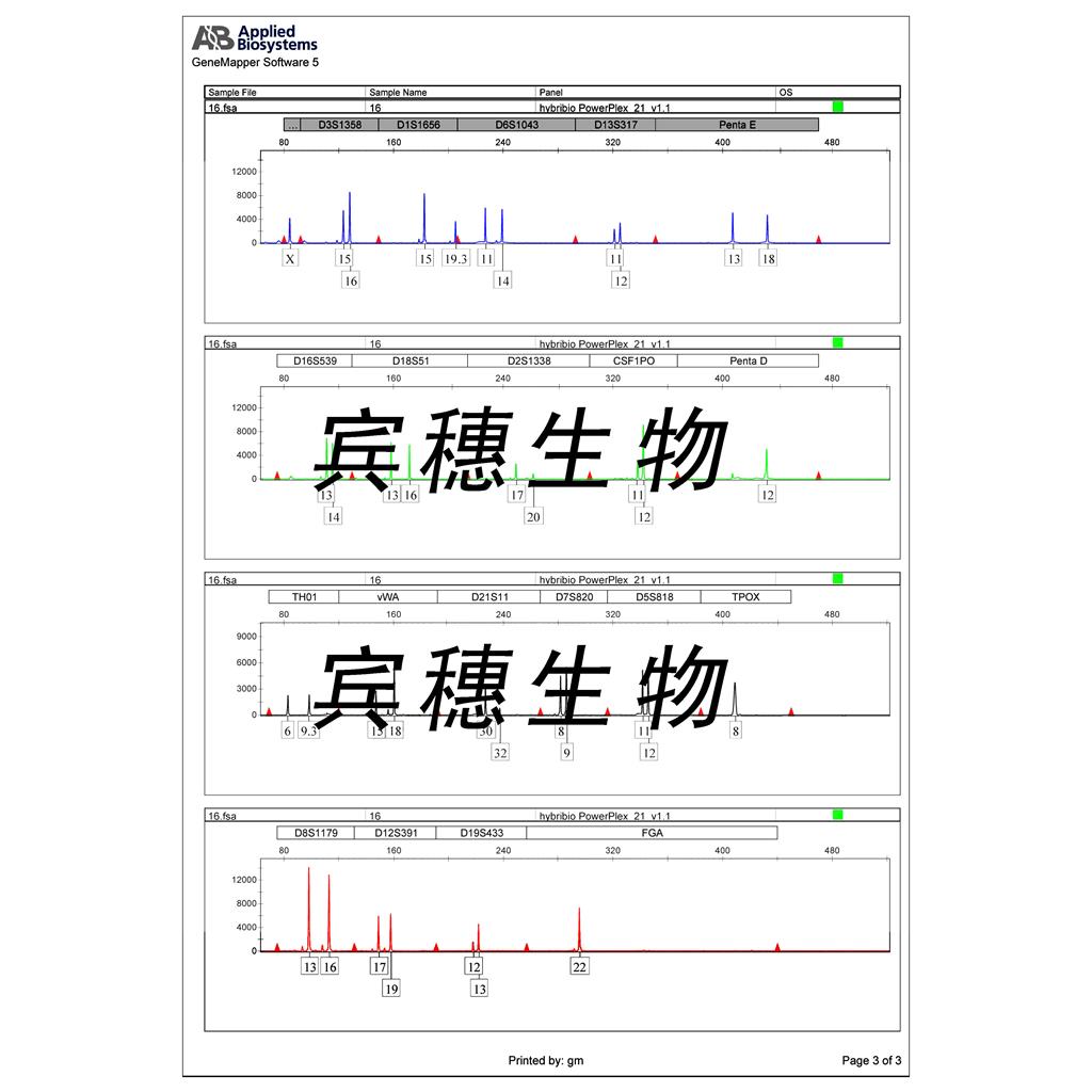 Hth83 Cells人甲狀腺癌貼壁細(xì)胞系(贈(zèng)送STR基因圖譜),Hth83 Cells