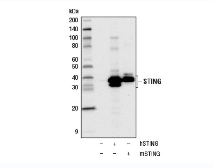 STING (D2P2F) 兔單克隆抗體,STING (D2P2F) Rabbit mAb