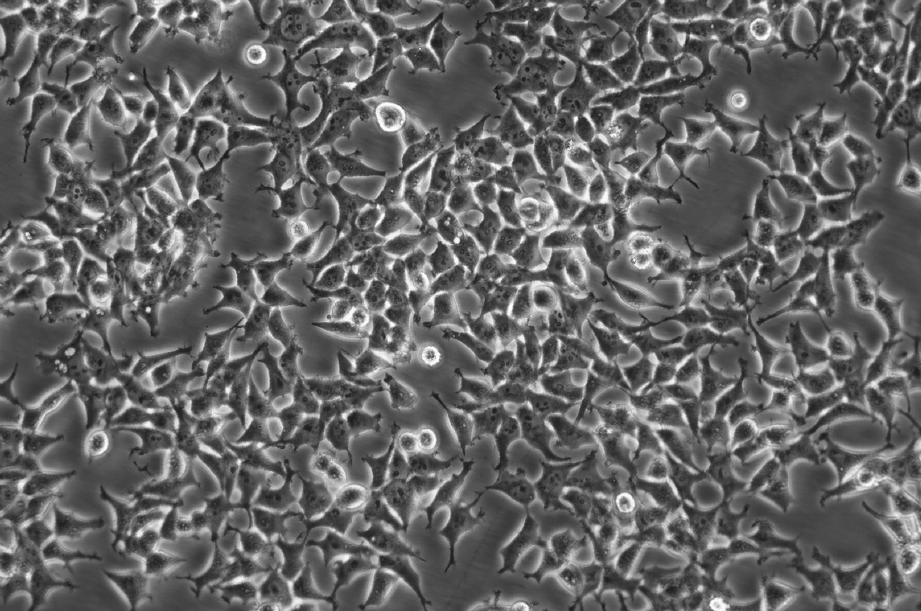 OP9 Cells小鼠骨髓基質(zhì)復(fù)蘇細(xì)胞系(有STR鑒定圖譜),OP9 Cells