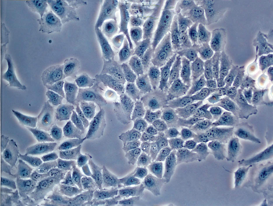 95-D[PLA-801D]人高轉移肺癌細胞系保種庫(附帶STR基因圖譜),95-D[PLA-801D]