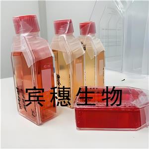 SW620 Cells人結(jié)腸癌復(fù)蘇細(xì)胞系(有STR鑒定圖譜),SW620 Cells