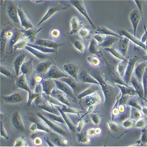 T24[T-24] Cells人膀胱移行細胞癌復蘇細胞系(有STR鑒定圖譜)