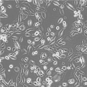 T84 Cells人結腸腺癌肺轉移復蘇細胞系(有STR鑒定圖譜)