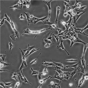 SK-MEL-1 Cells人皮肤黑色素瘤复苏细胞系(有STR鉴定图谱)