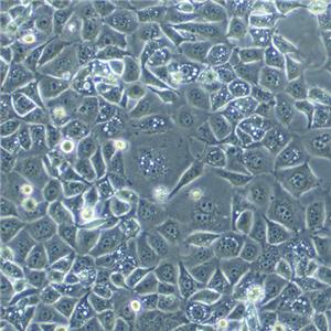 SK-NEP-1 Cells人肾母细胞瘤复苏细胞系(有STR鉴定图谱)