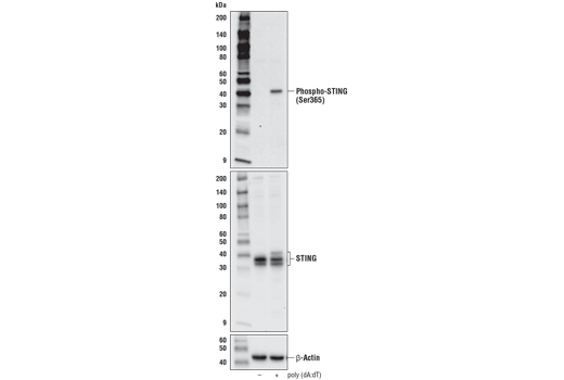 磷酸化STING（Ser365）（D8F4W）兔單克隆抗體,Phospho-STING (Ser365) (D8F4W) Rabbit mAb