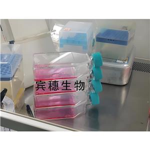 NCI-H1693人肺腺癌細(xì)胞系保種庫(kù)(附帶STR基因圖譜),NCI-H1693