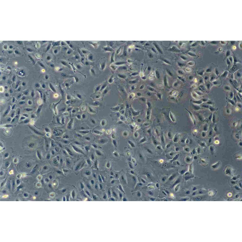 SK-MEL-1 Cells人皮膚黑色素瘤可傳代細(xì)胞系(送STR鑒定圖譜),SK-MEL-1 Cells