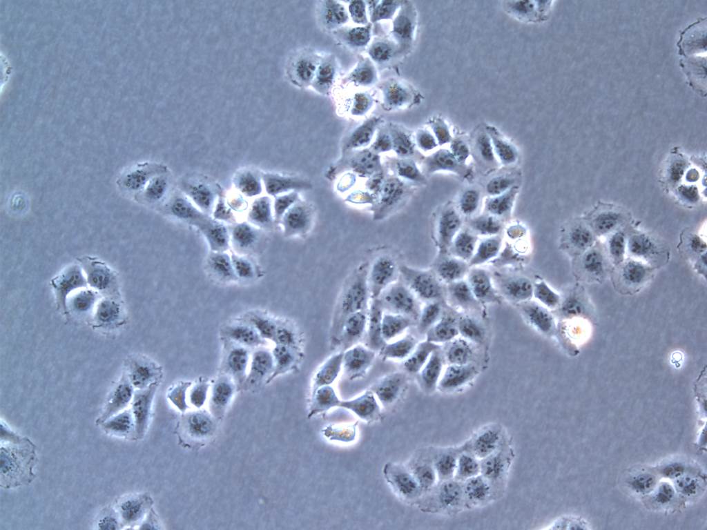 PaTu 8988t Cells人胰腺癌可傳代細胞系(送STR鑒定圖譜),PaTu 8988t Cells