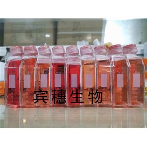 NCI-H660 Cells人神經(jīng)內(nèi)分泌前列腺癌可傳代細(xì)胞系(送STR鑒定圖譜),NCI-H660 Cells