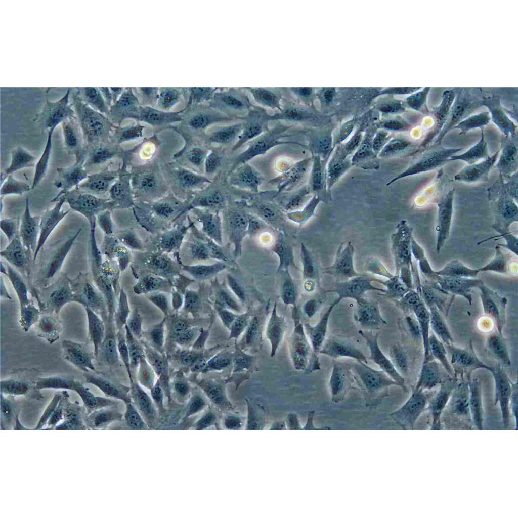 A172 Cells人膠質(zhì)母細胞瘤貼壁細胞系(贈送STR基因圖譜),A172 Cells