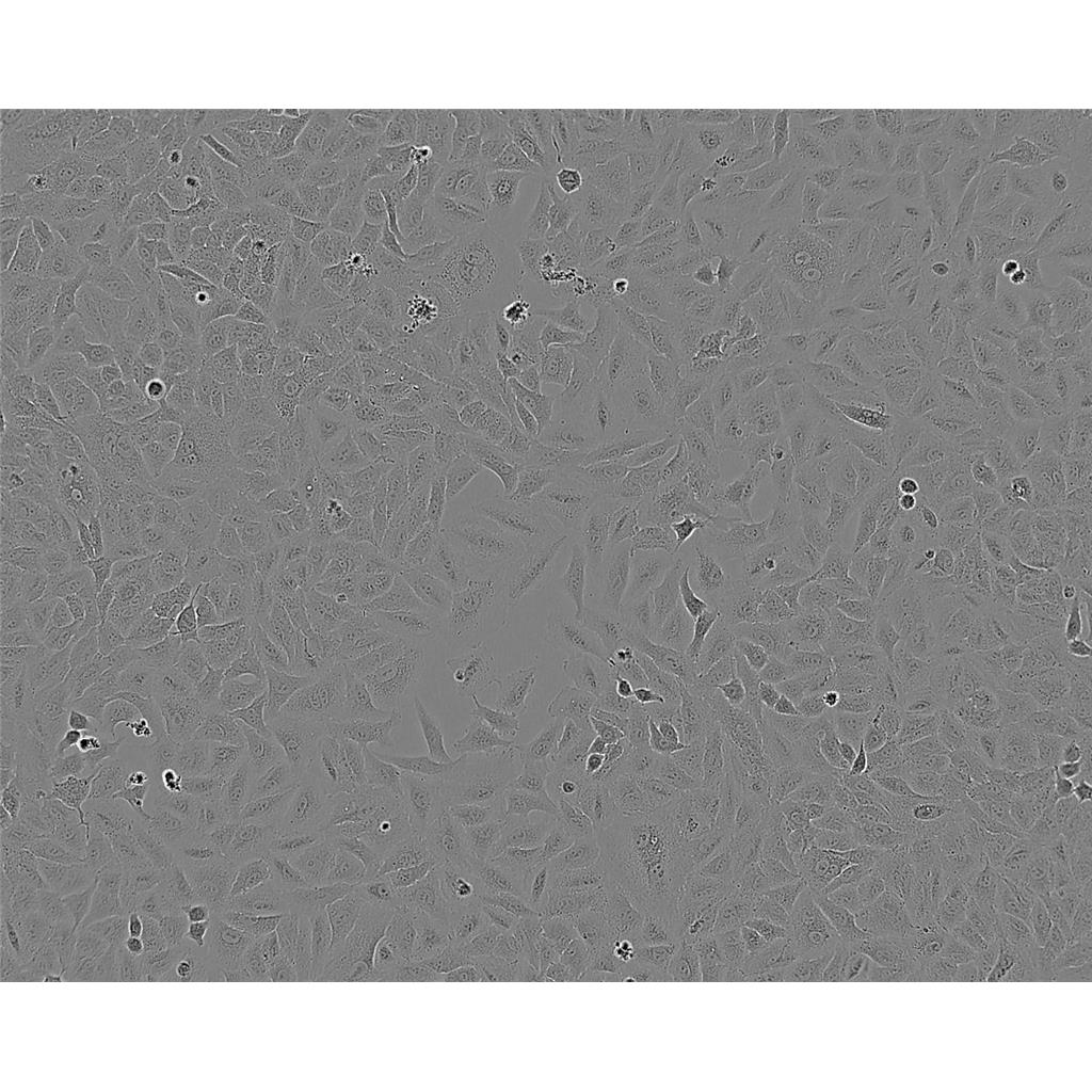 HCC1143 Cells人乳腺癌貼壁細(xì)胞系(贈(zèng)送STR基因圖譜),HCC1143 Cells