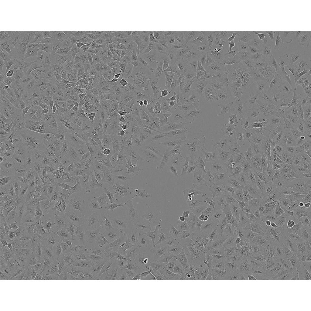 UM-SCC-1 Cells人口底鱗癌貼壁細(xì)胞系(贈(zèng)送STR基因圖譜),UM-SCC-1 Cells