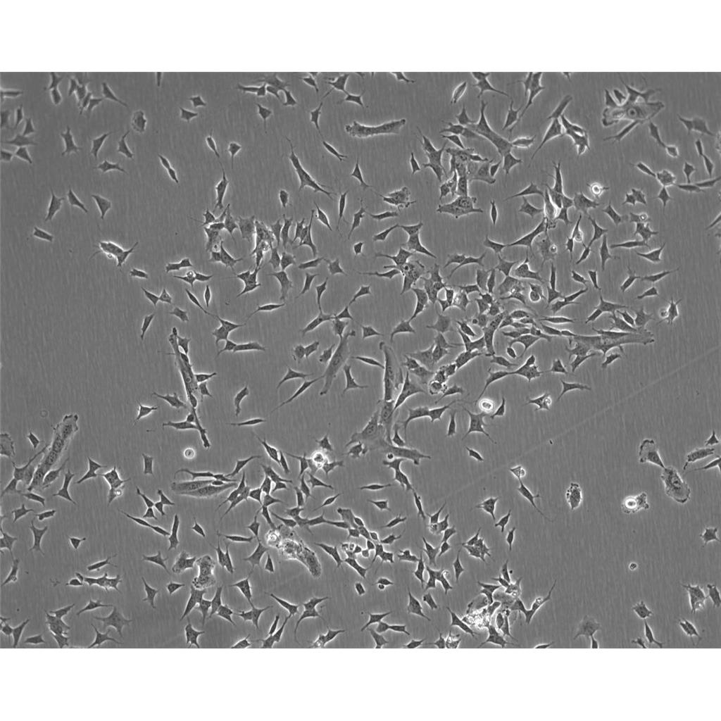 HCC1833 Cells人肺癌腺癌貼壁細(xì)胞系(贈送STR基因圖譜),HCC1833 Cells