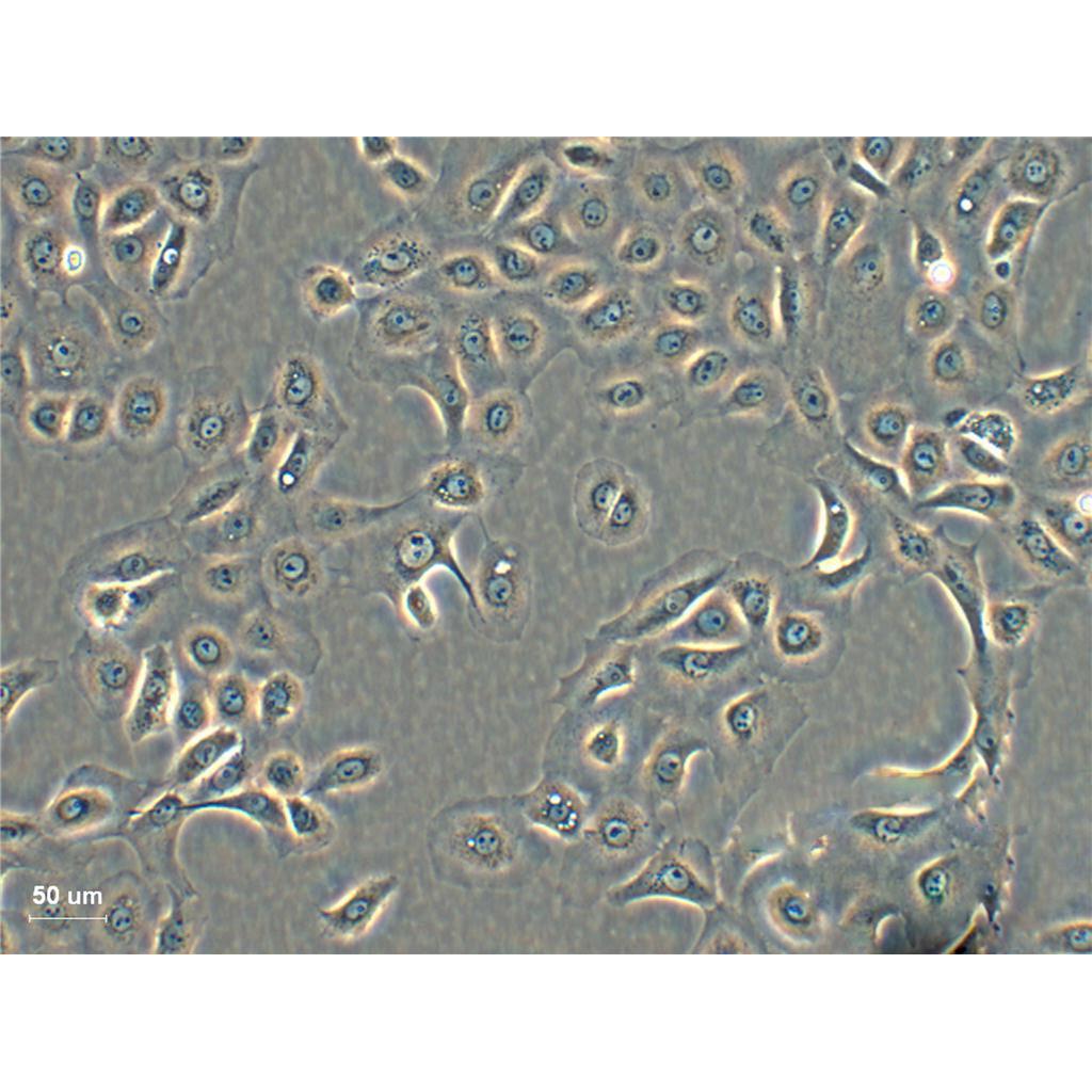 MeWo Cells人惡性黑色素瘤貼壁細(xì)胞系(贈送STR基因圖譜),MeWo Cells