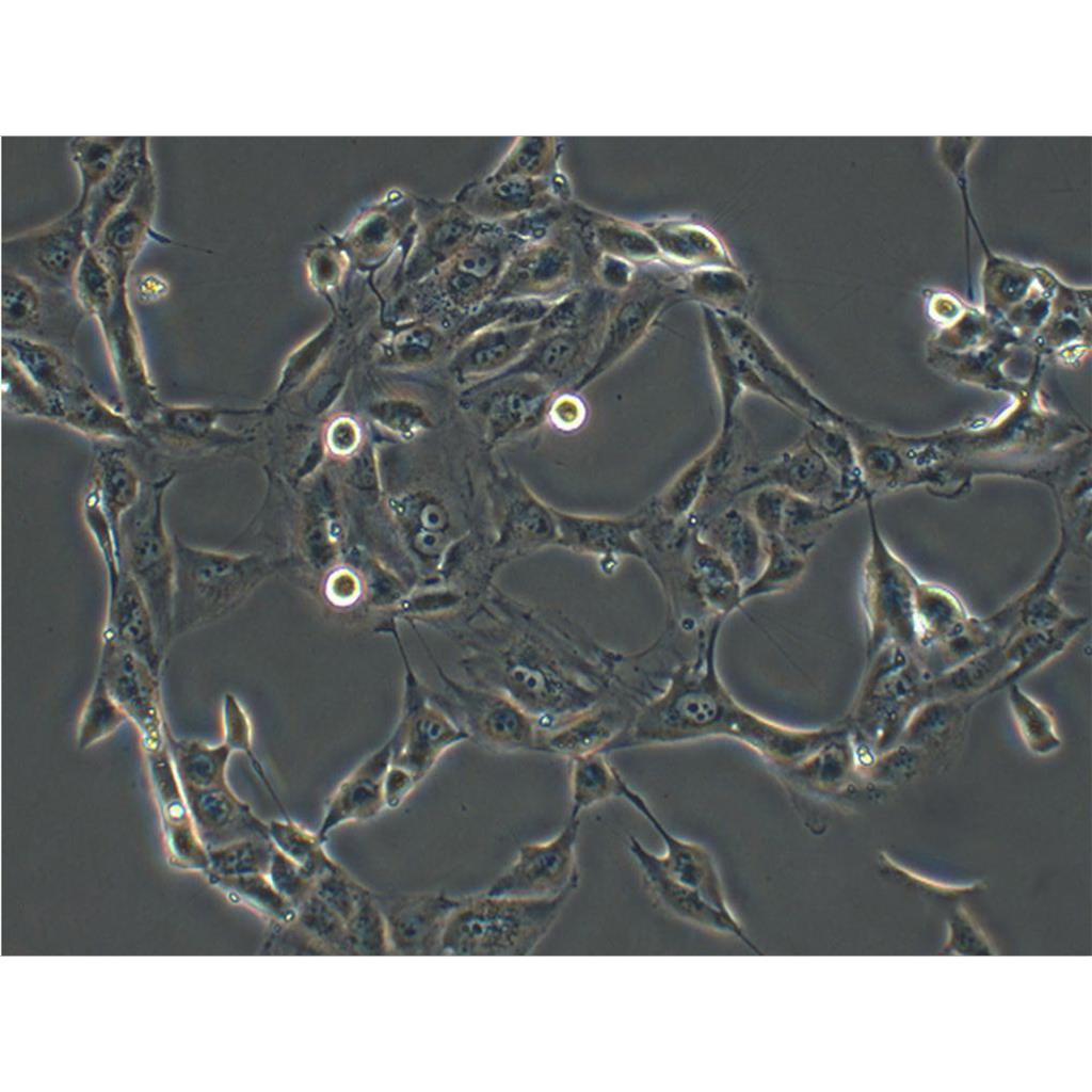 SACC-83 Cells人涎腺腺樣囊性癌貼壁細(xì)胞系(贈(zèng)送STR基因圖譜),SACC-83 Cells