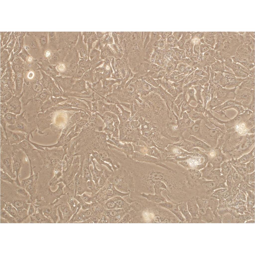 OVCA429 Cells人卵巢癌貼壁細(xì)胞系(贈(zèng)送STR基因圖譜),OVCA429 Cells