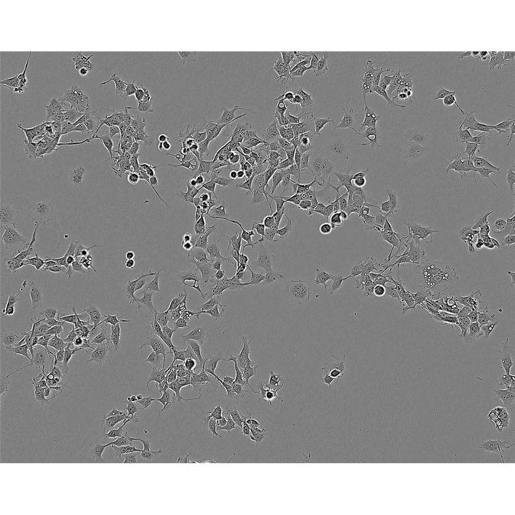 HCC1428 Cells人乳腺腺癌貼壁細(xì)胞系(贈(zèng)送STR基因圖譜),HCC1428 Cells