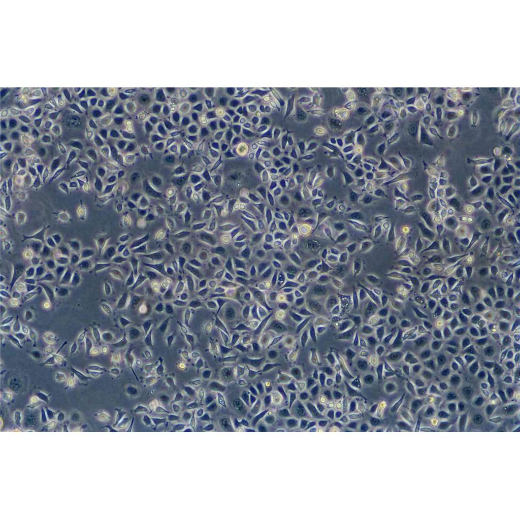 HCC4006 Cells人肺癌腺癌貼壁細(xì)胞系(贈送STR基因圖譜),HCC4006 Cells