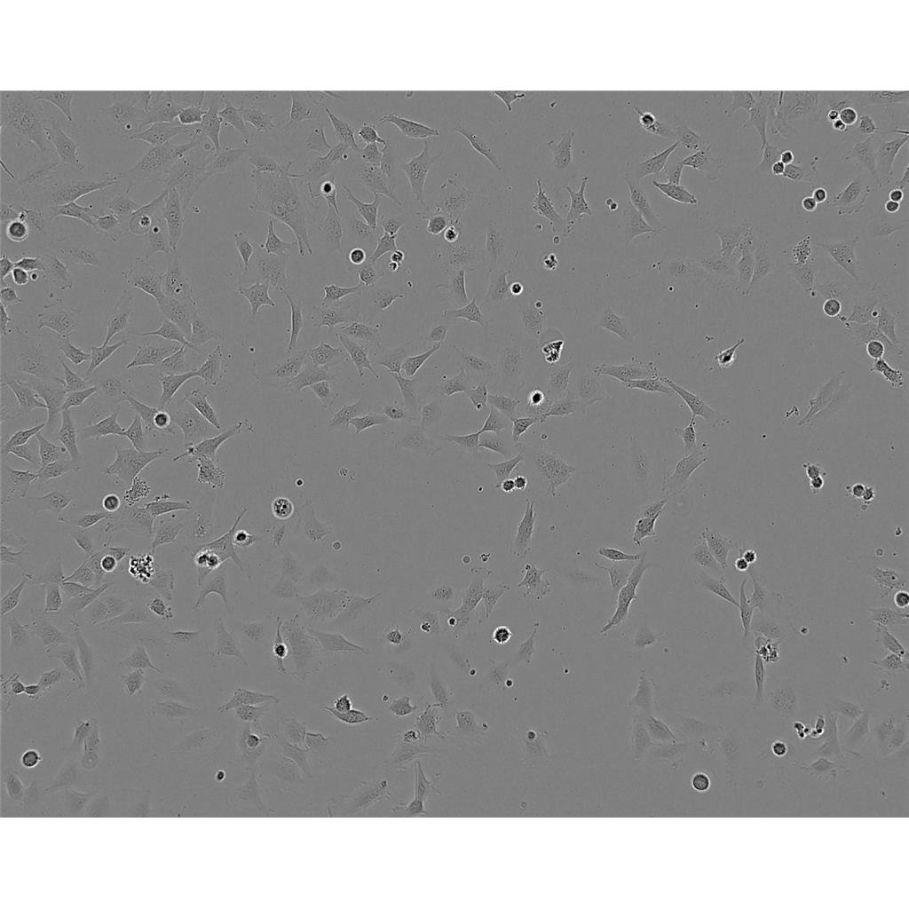 TE-12 Cells人食管癌貼壁細胞系(贈送STR基因圖譜),TE-12 Cells