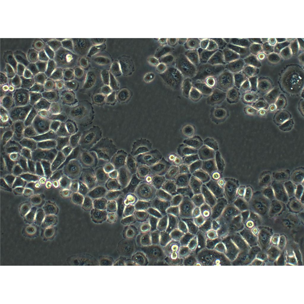 Mahlavu Cells人肝癌貼壁細(xì)胞系(贈(zèng)送STR基因圖譜),Mahlavu Cells