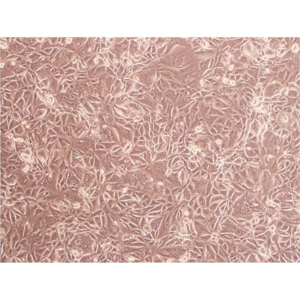 DU4475 Cells人乳腺上皮貼壁細(xì)胞系(贈送STR基因圖譜),DU4475 Cells