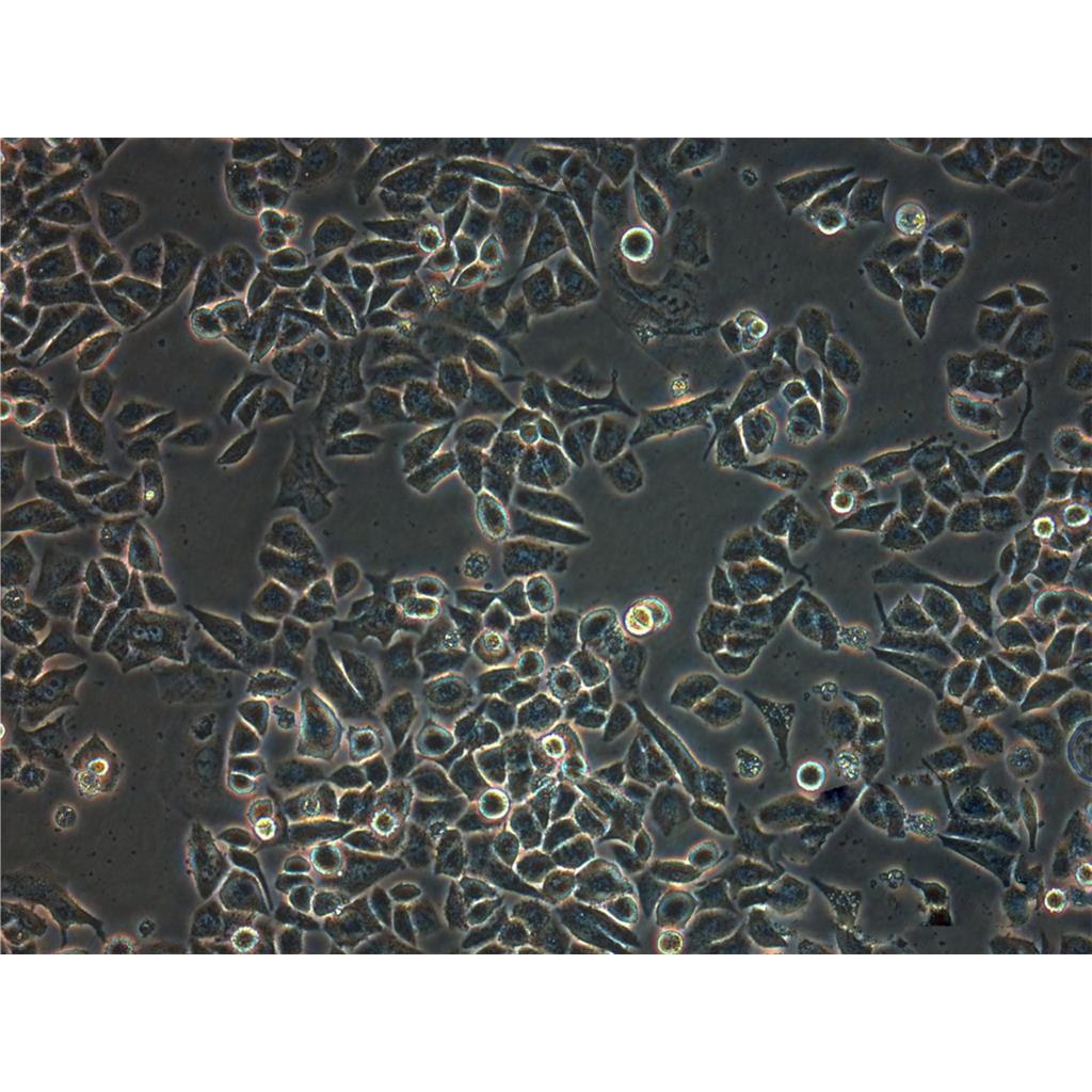 Capan-2 Cells人胰腺癌貼壁細(xì)胞系(贈(zèng)送STR基因圖譜),Capan-2 Cells